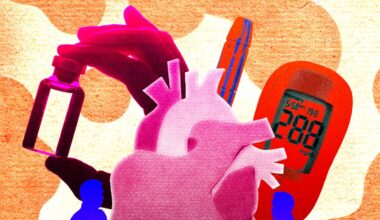 Testing for ‘Bad Cholesterol’ Doesn’t Tell the Whole Story