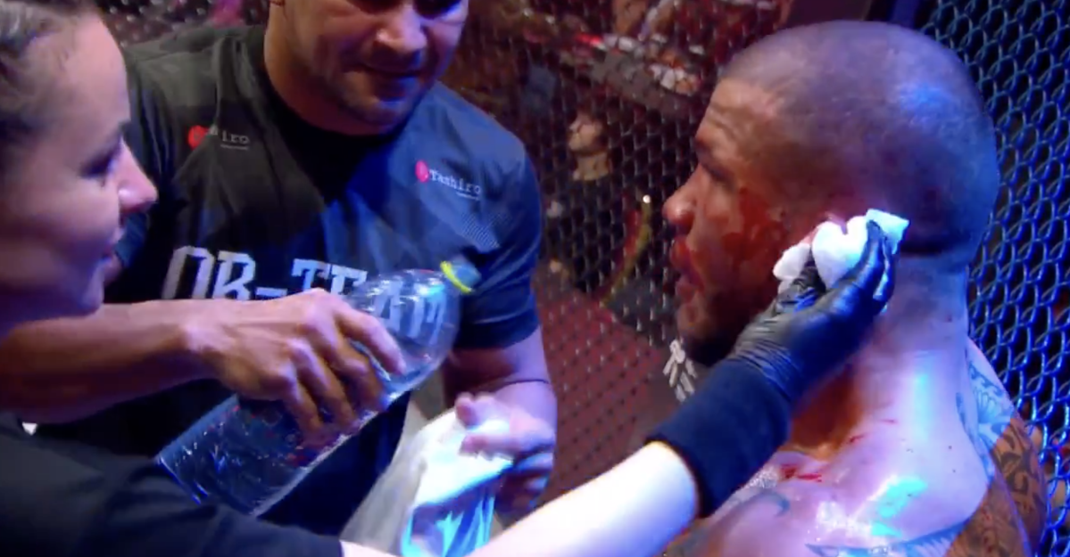 Missed Fists: Valmir da Silva loses fight after cauliflower ear explodes