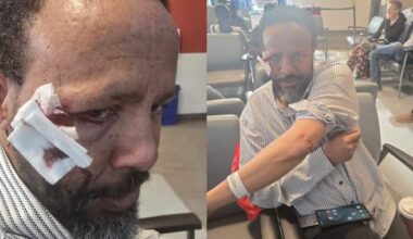 Attack after Friday prayers at St. Albert mosque leads to aggravated assault charge