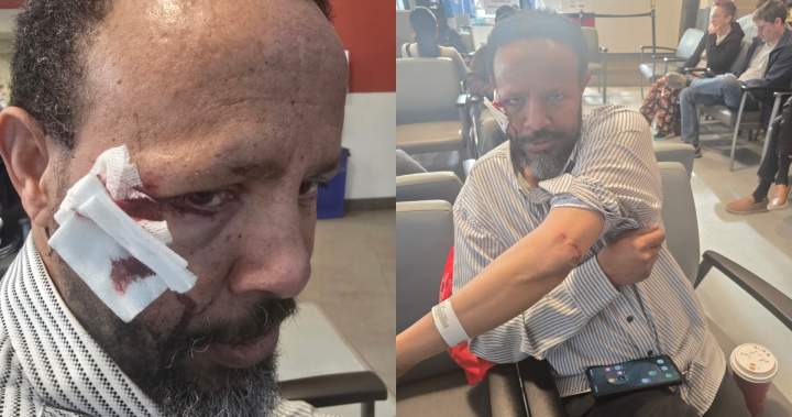 Attack after Friday prayers at St. Albert mosque leads to aggravated assault charge