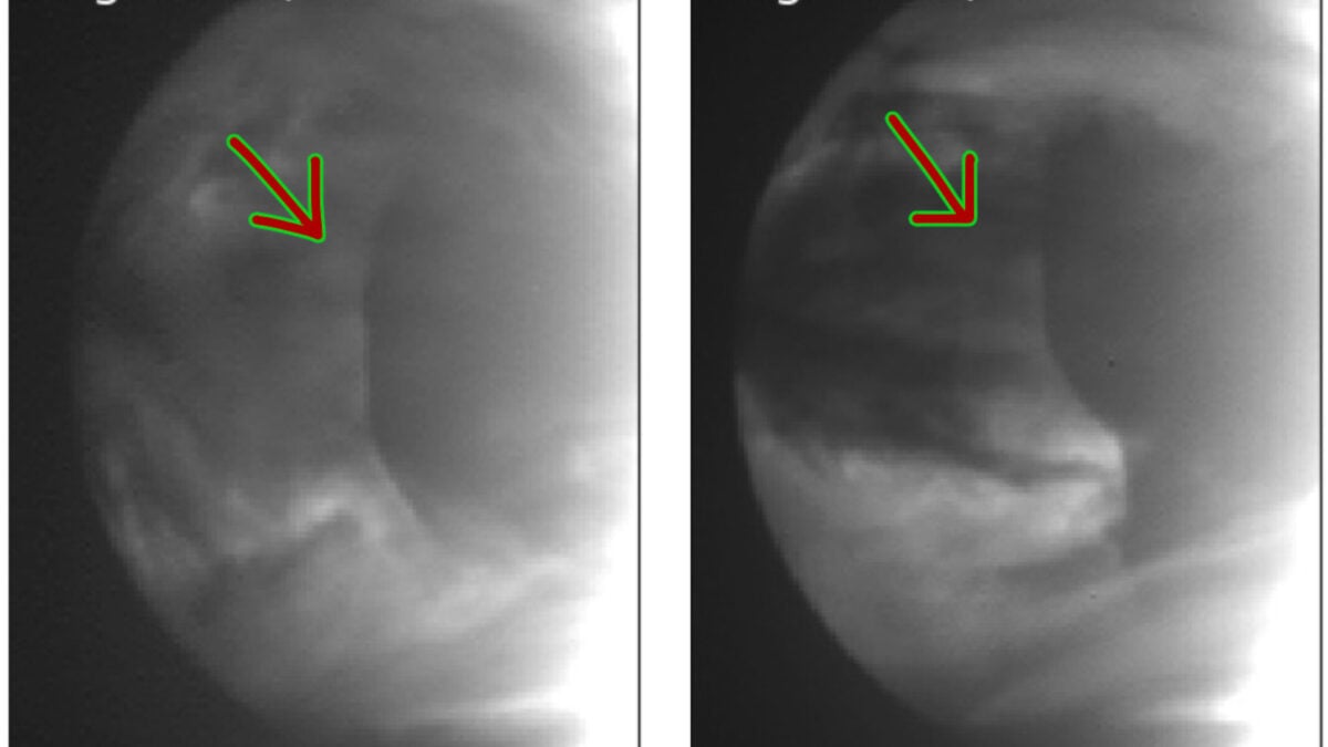 A Gigantic Atmospheric Anomaly Keeps Showing Up on Venus. Astronomers Finally Know Why