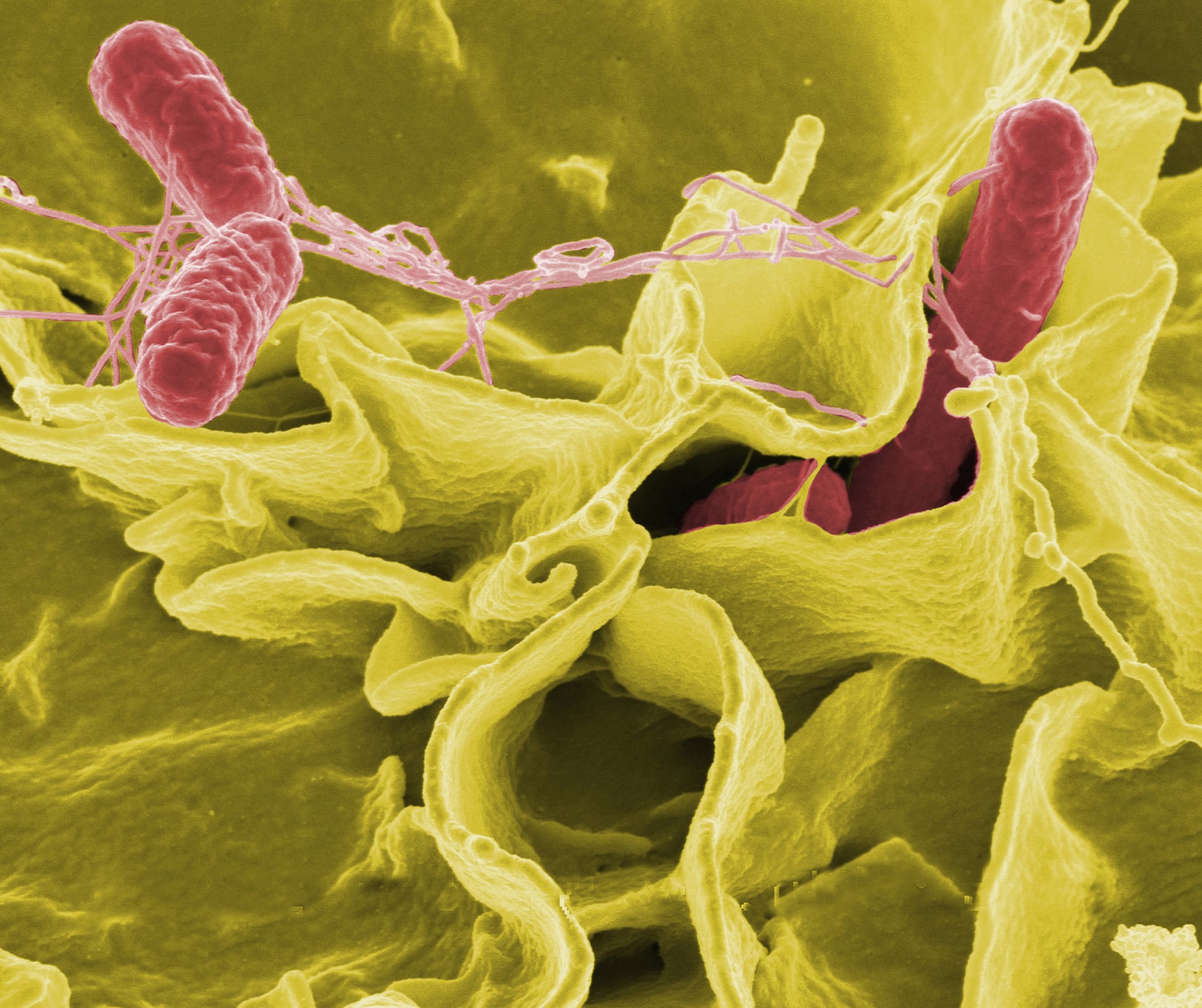 SEM of Salmonella typhimurium (red)  invading cultured human cells