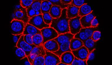Experimental pill promises new hope for deadly pancreatic cancer