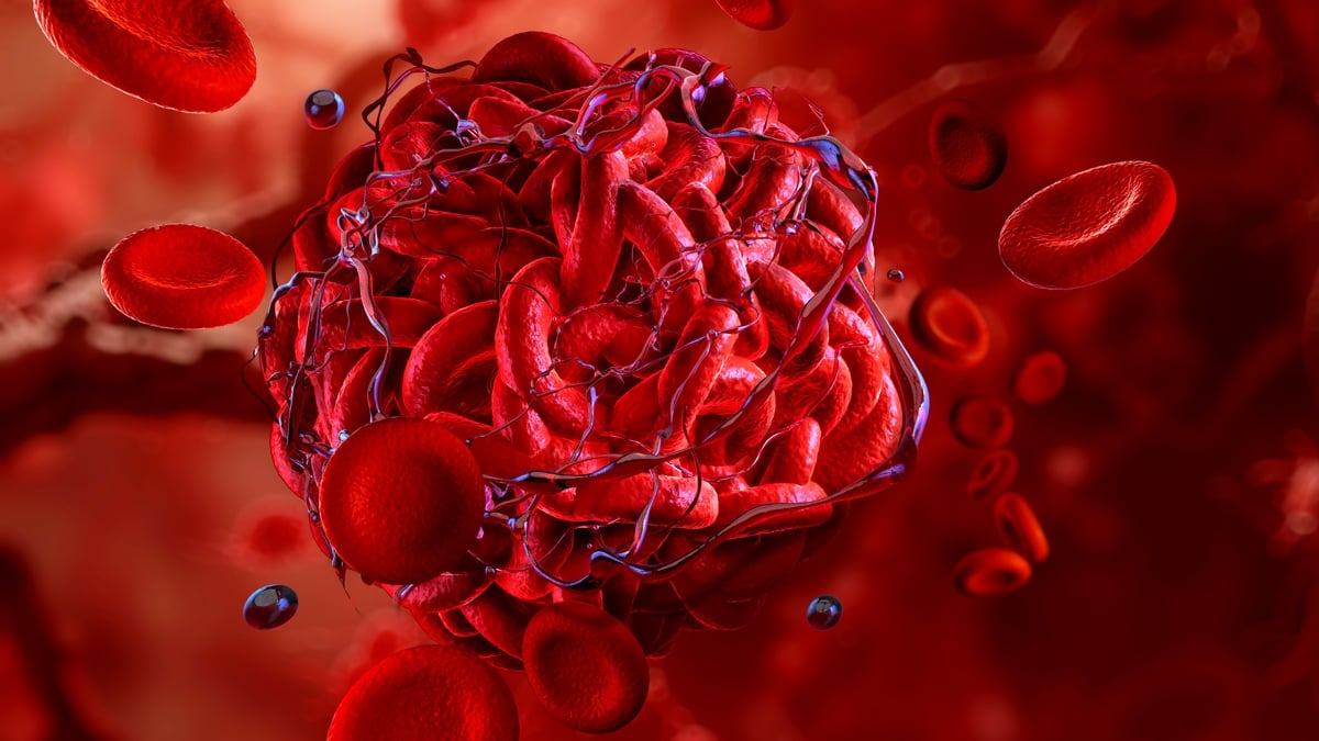 Scientists Engineer Blood Clots That Stop Severe Bleeding in Seconds : ScienceAlert
