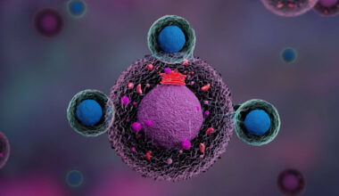 A Canadian first: Allogeneic CAR-T cells to treat autoimmune Diseases