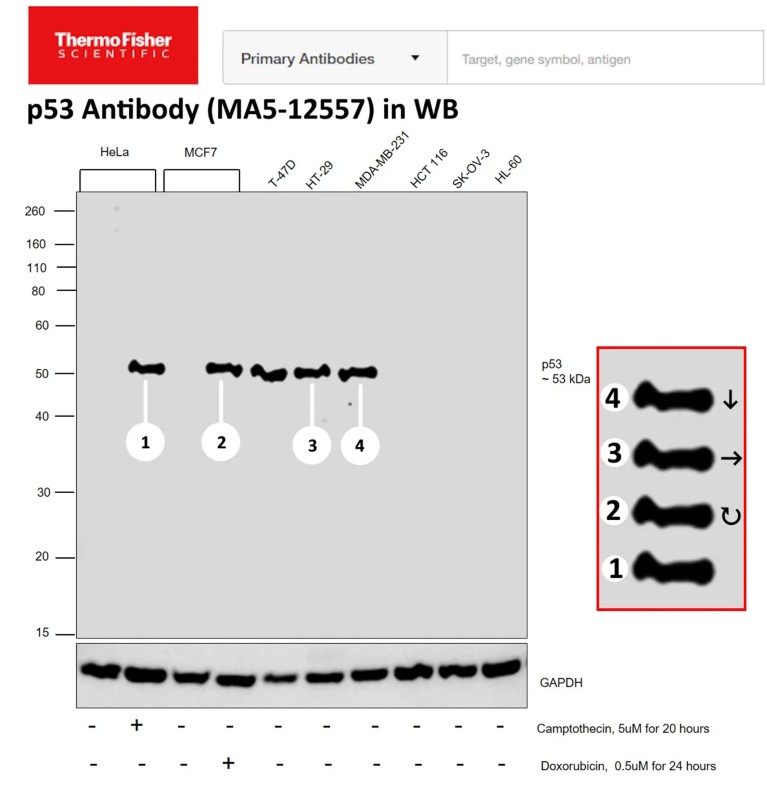 Image of a western blot annotation performed using Anti-p53 Monoclonal Antibody.