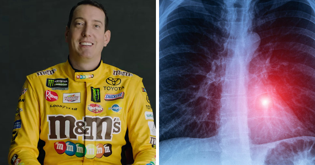 Doctors Reveal Dangers Of Life-Threatening Condition That Led To NASCAR Star Kyle Busch's Sudden Passing At 41