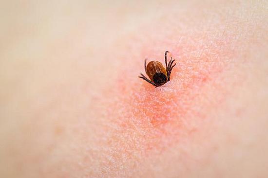 The problem with "classic" Lyme disease symptoms