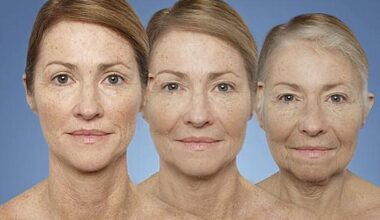 What factors speed up aging?