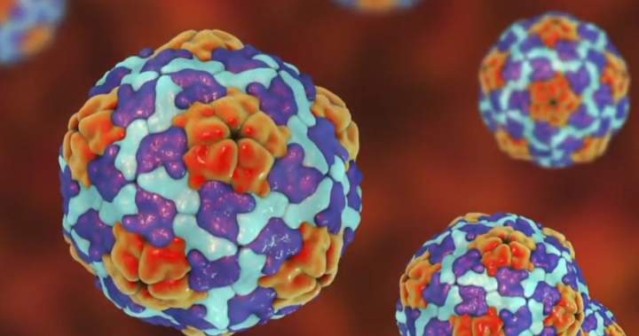 Manitoba health officials say ongoing hepatitis A outbreak has worsened - Winnipeg