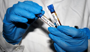 Is hantavirus like COVID-19? Five infectious disease experts answer some of the biggest questions about the outbreak.