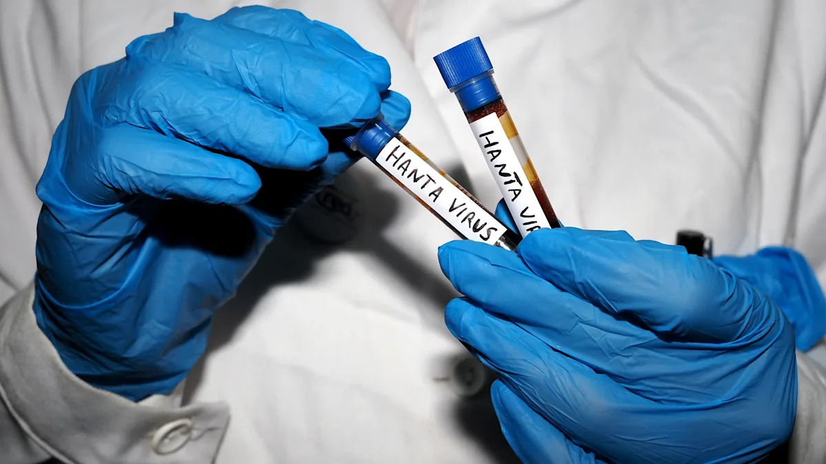 Is hantavirus like COVID-19? Five infectious disease experts answer some of the biggest questions about the outbreak.