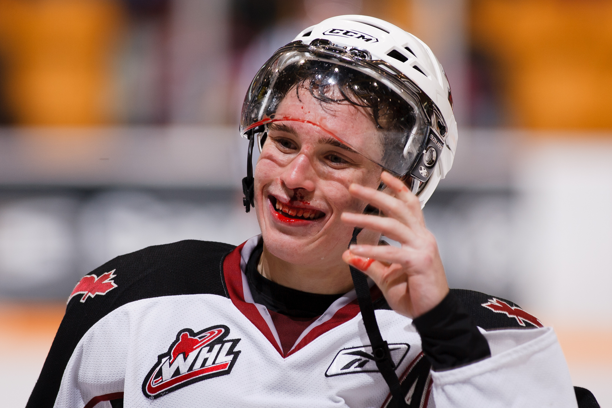 Brendan Gallagher smiles with a bloody mouth and bloody visor.