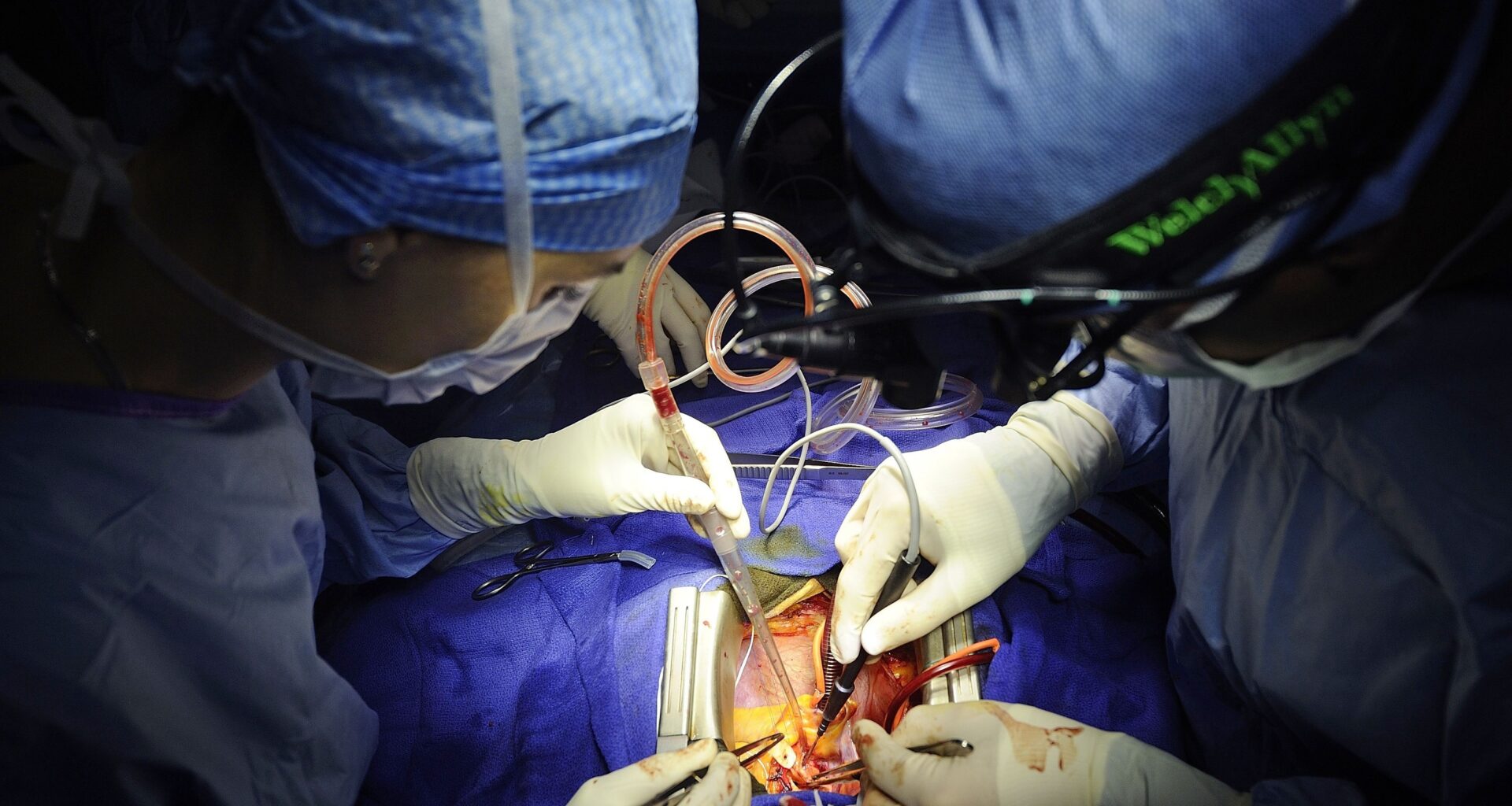 Open heart surgery