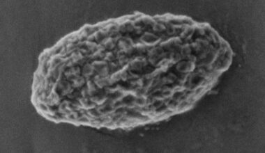 Glycogen phosphatase modulates brain metabolism