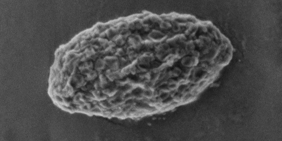 Glycogen phosphatase modulates brain metabolism