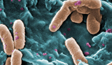 Pathogen forms biofilms when temperatures drop
