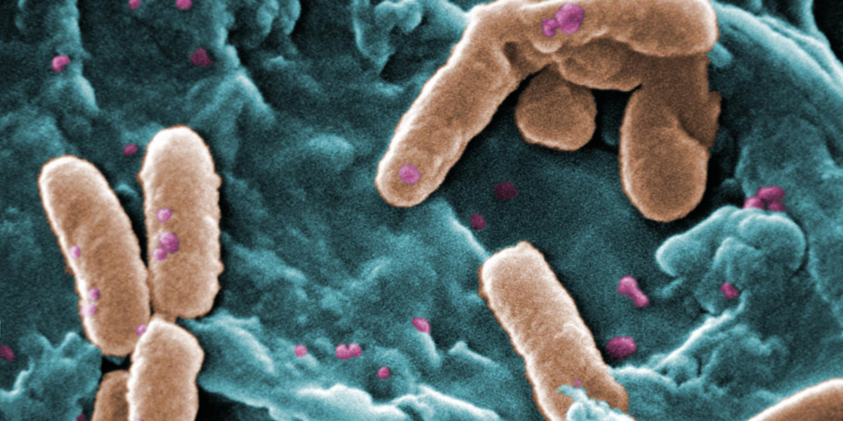 Pathogen forms biofilms when temperatures drop