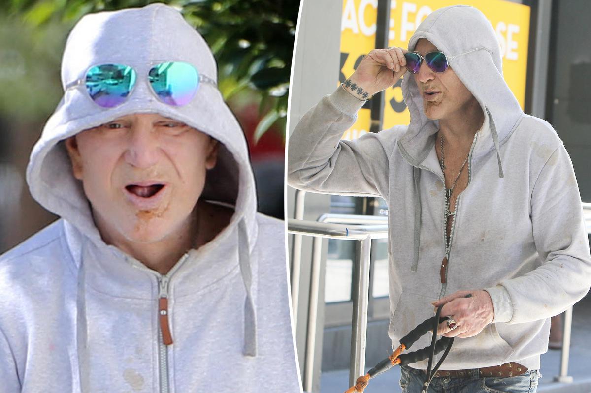 Mickey Rourke shows off missing teeth after being evicted from LA home