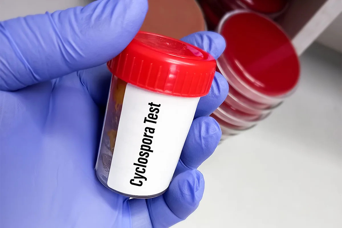 A Parasite Found in Contaminated Food Is Spreading Across Michigan as Health Officials Issue Warning