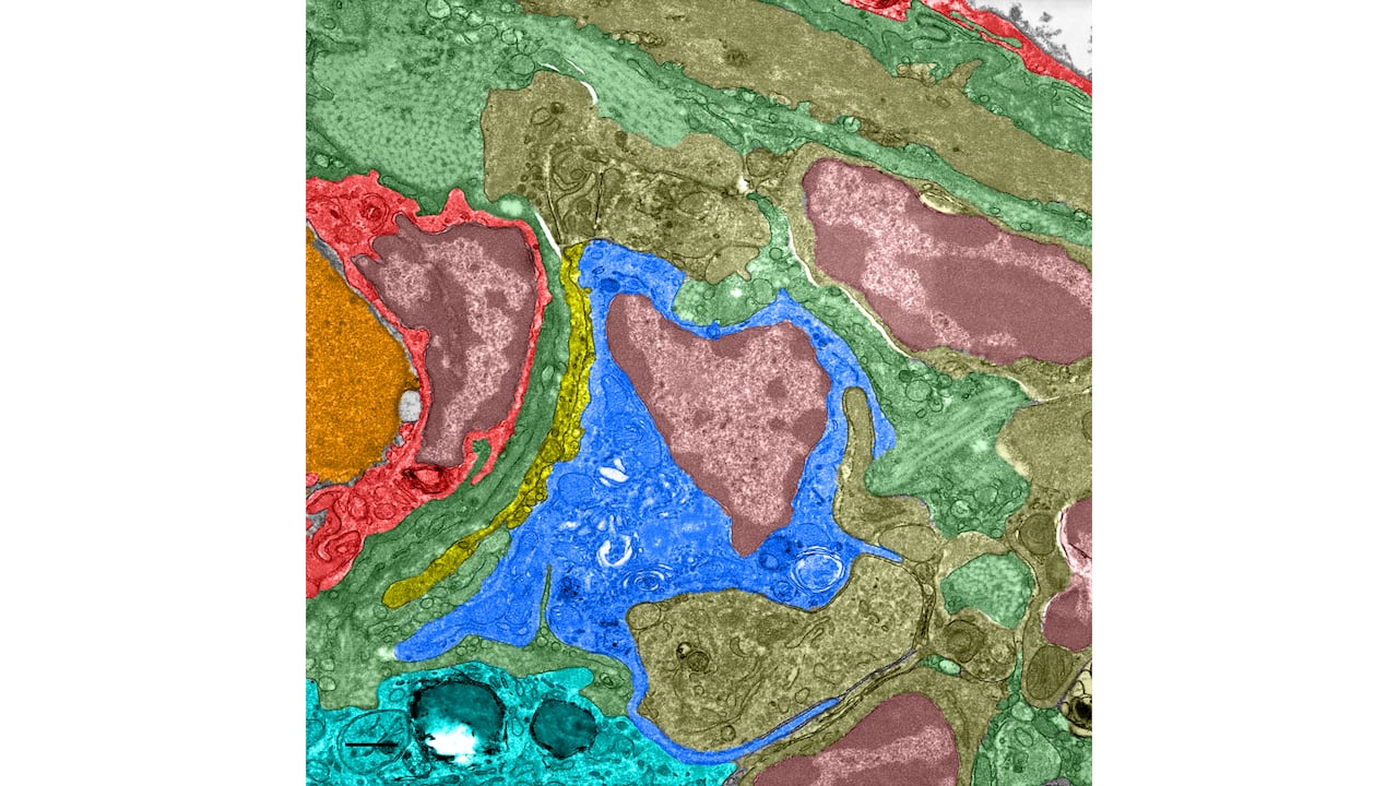 A square image that shows a mix of red, blue, burgundy, and green splotches.