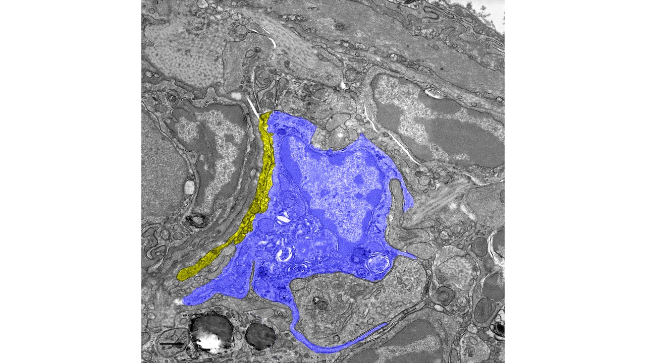 A square image that shows splotches of blue, grey, and yellow.