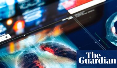 Doctors and NHS could be sued for mistakes made by AI tools, report warns | NHS