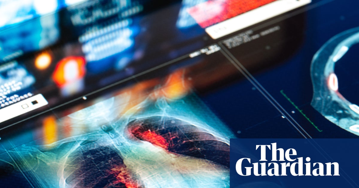 Doctors and NHS could be sued for mistakes made by AI tools, report warns | NHS