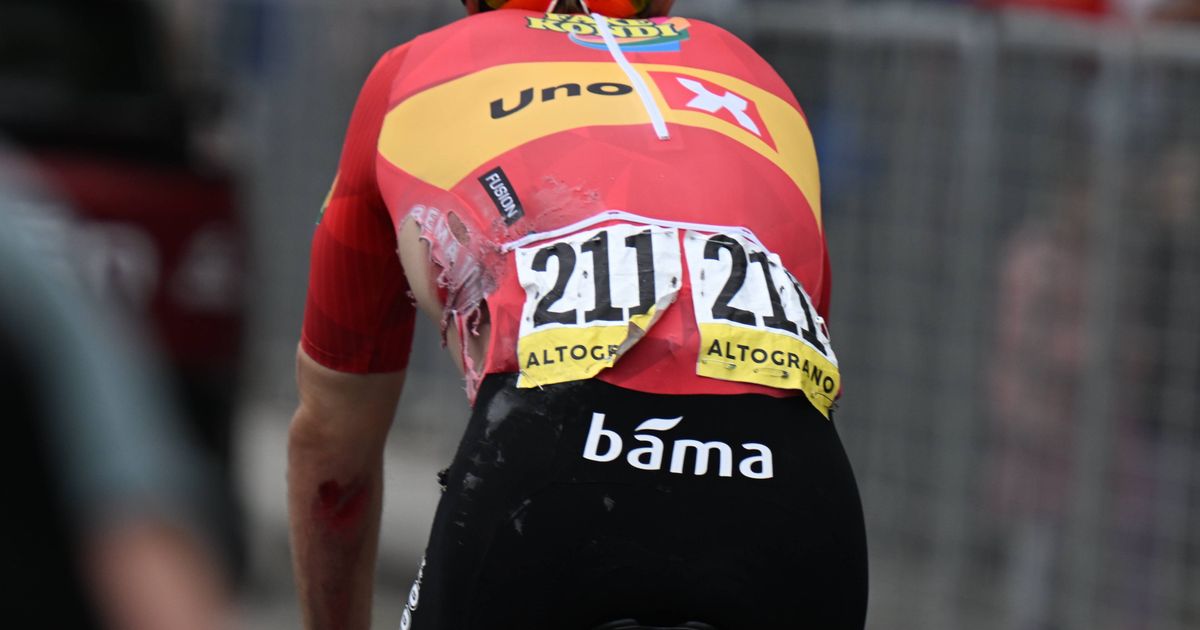 Unbelievable: Cyclist rode the Giro d'Italia for 10 days with 4 (!) fractures