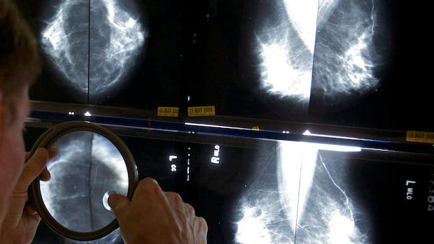 Calgary doctor selected to lead national committee on preventive health services