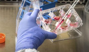 Neumora Ends Depression Drug Programme and Announces Workforce Reduction (NMRA)