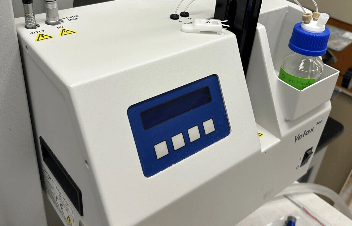 University of Florida Researchers Develop Rapid Urine Test for Prostate Cancer