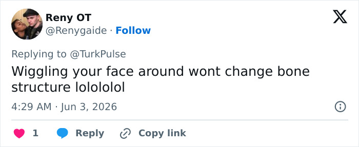 Tweet arguing daily jaw exercises won't change bone structure Tweet arguing daily jaw exercises won't change bone structure