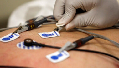 Doctors Thought It Was Asthma. A.I. Flagged a Serious Heart Problem.