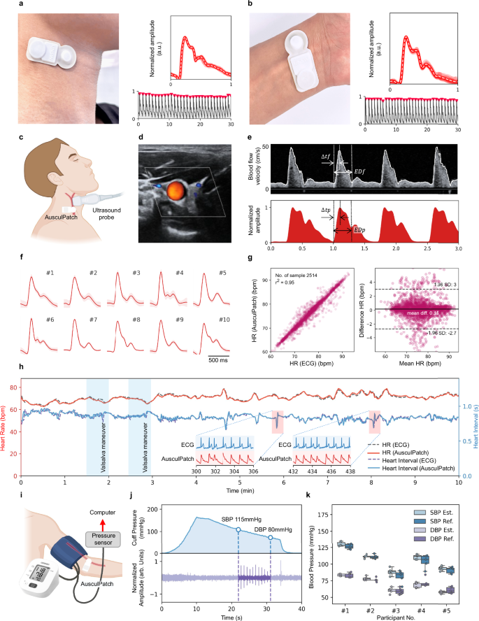 Fig. 4: Measuring body acoustic signals from arteries.