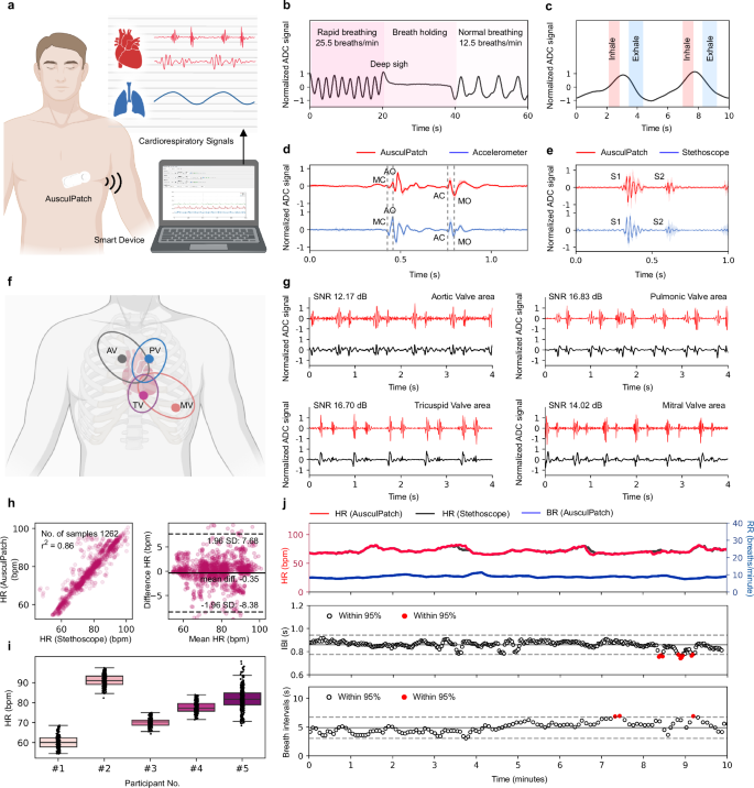 Fig. 5: Cardiorespiratory measurements.