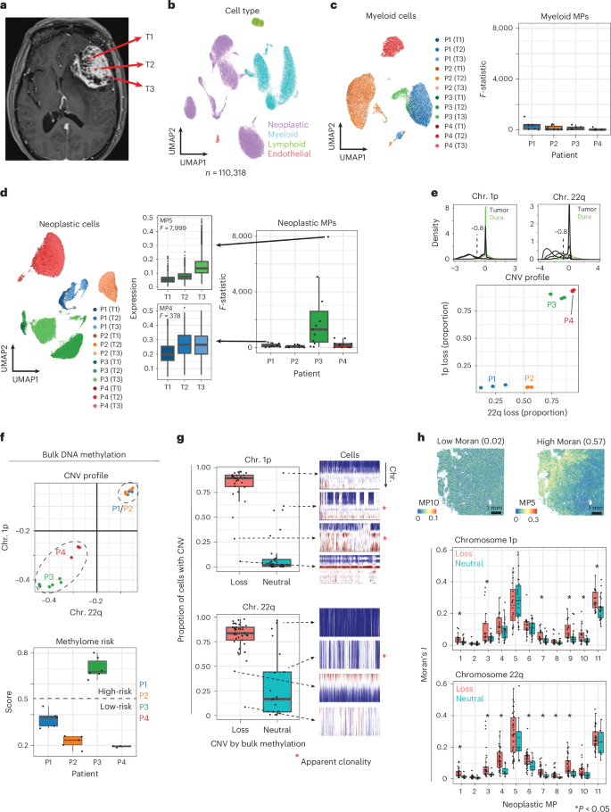 Fig. 2: Regionally diverse sampling within the same meningiomas identifies transcriptional intra-tumoral heterogeneity but comparatively stable copy number alterations.