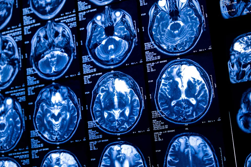 MRI brain scans displayed in a grid, showcasing different slices and views for medical analysis