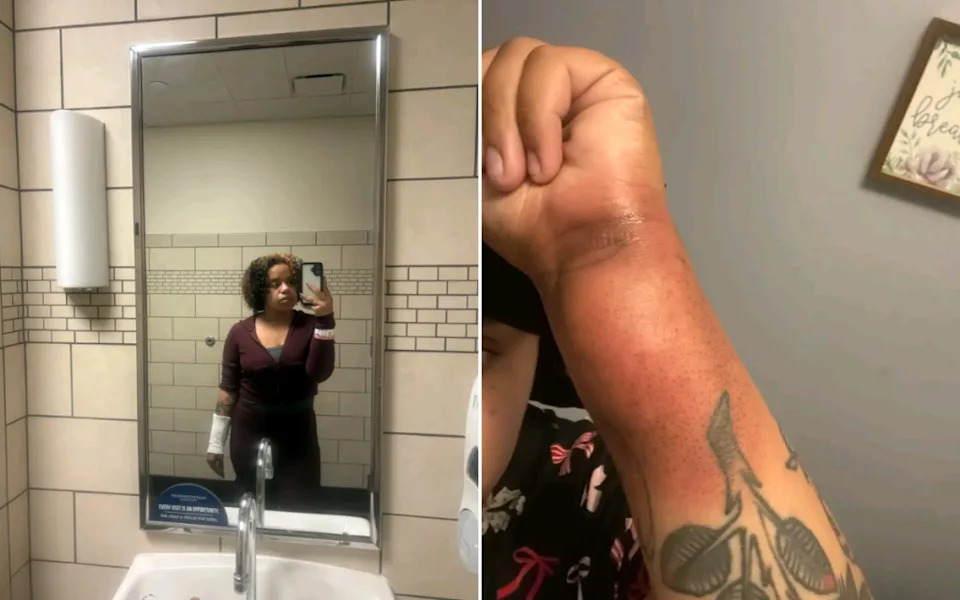 Sara Kasperowicz's arm.