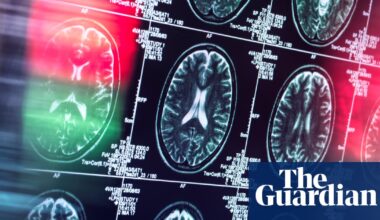 Antidepressants and antipsychotics could serve as alternatives to opioids, study finds | Opioids