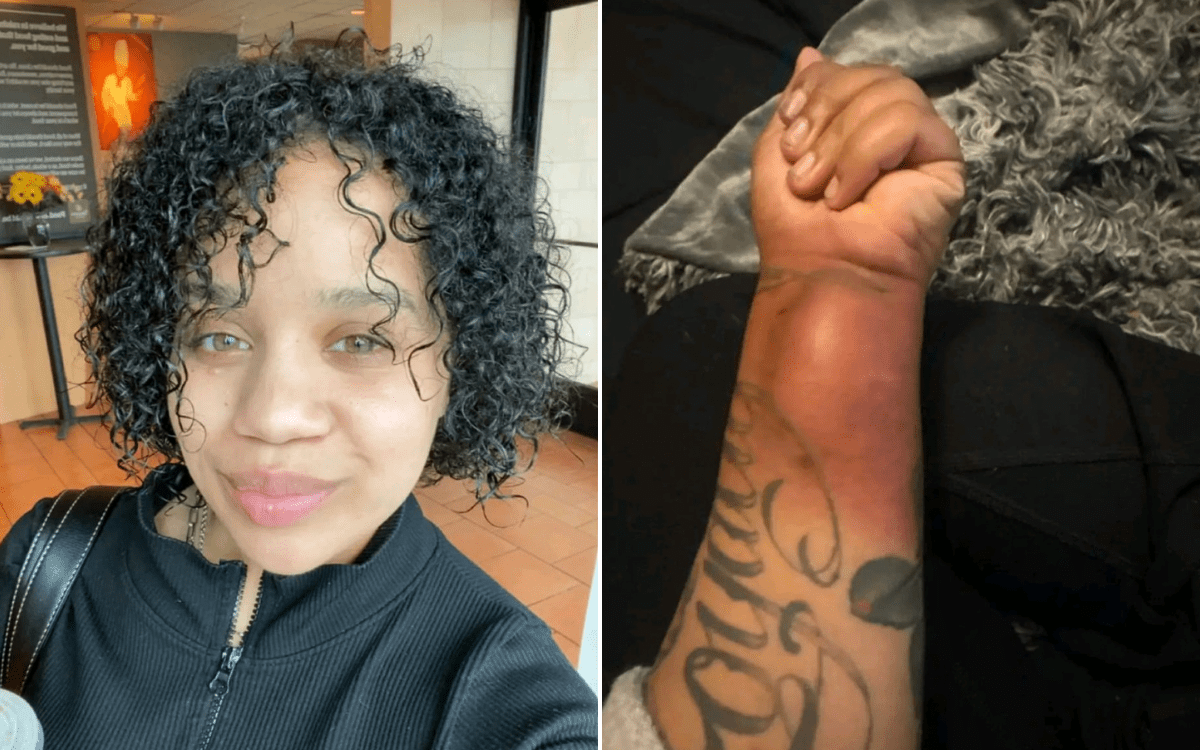 She had 28 tumors on her body, then one began to grow at an alarming rate