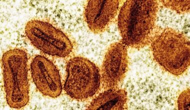 2 scientists charged with bringing deactivated mpox virus into the US and lying to authorities - Toronto Star
