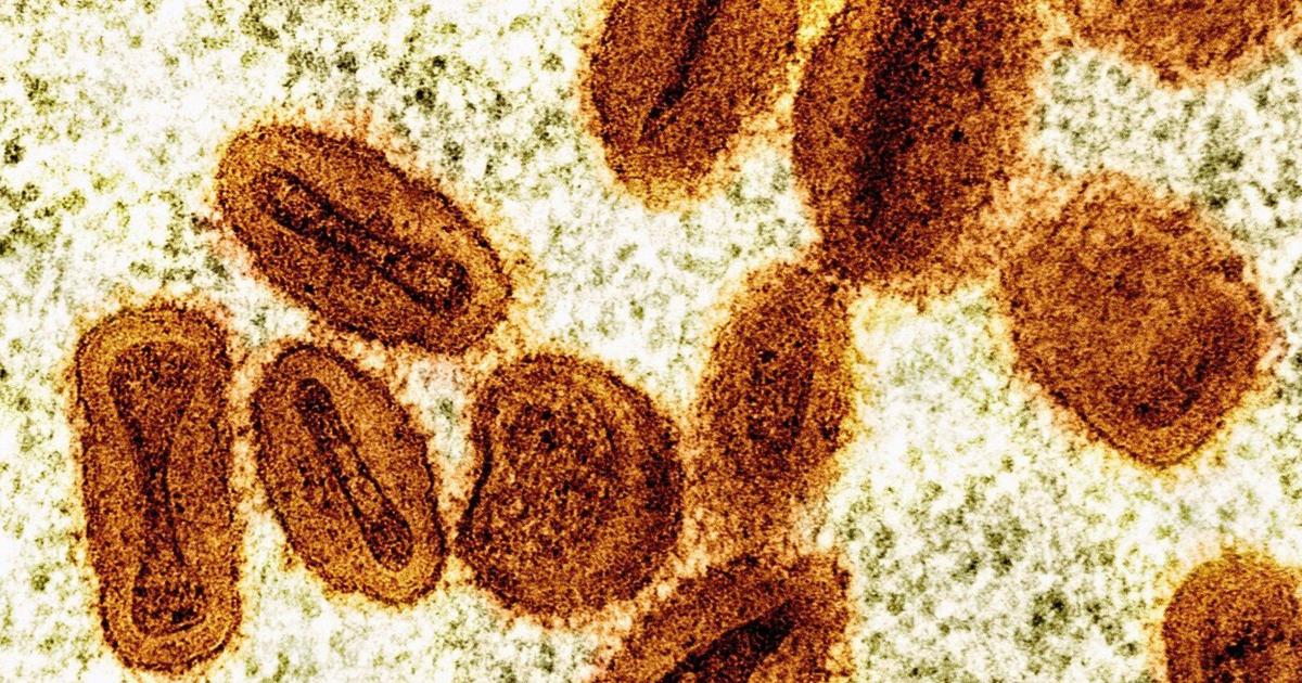 2 scientists charged with bringing deactivated mpox virus into the US and lying to authorities - Toronto Star