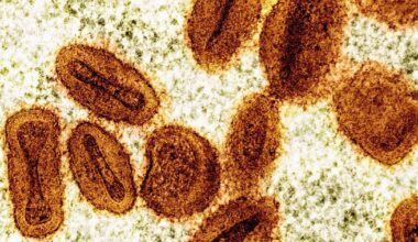2 scientists charged with bringing deactivated mpox virus into the US and lying to authorities - thecanadianpressnews.ca
