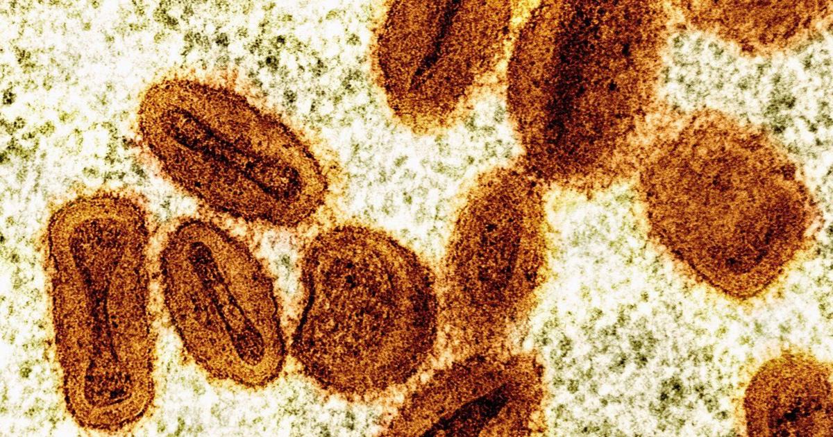 2 scientists charged with bringing deactivated mpox virus into the US and lying to authorities - thecanadianpressnews.ca