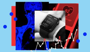 Wearables, Health-Tracking Apps Are Stressing Users, Causing Harm