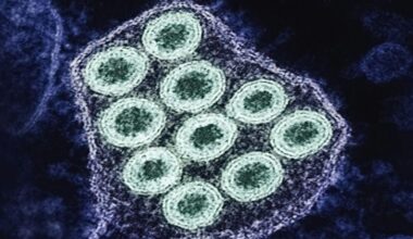 Doctors urge caution after rare rabies death in Canadian boy - Vermont Community Newspaper Group