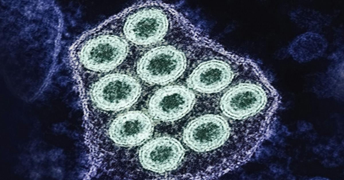 Doctors urge caution after rare rabies death in Canadian boy - Vermont Community Newspaper Group