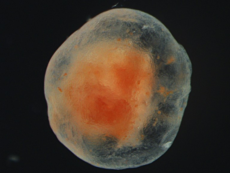 Microscopic photo of a live tube foot at several years old.