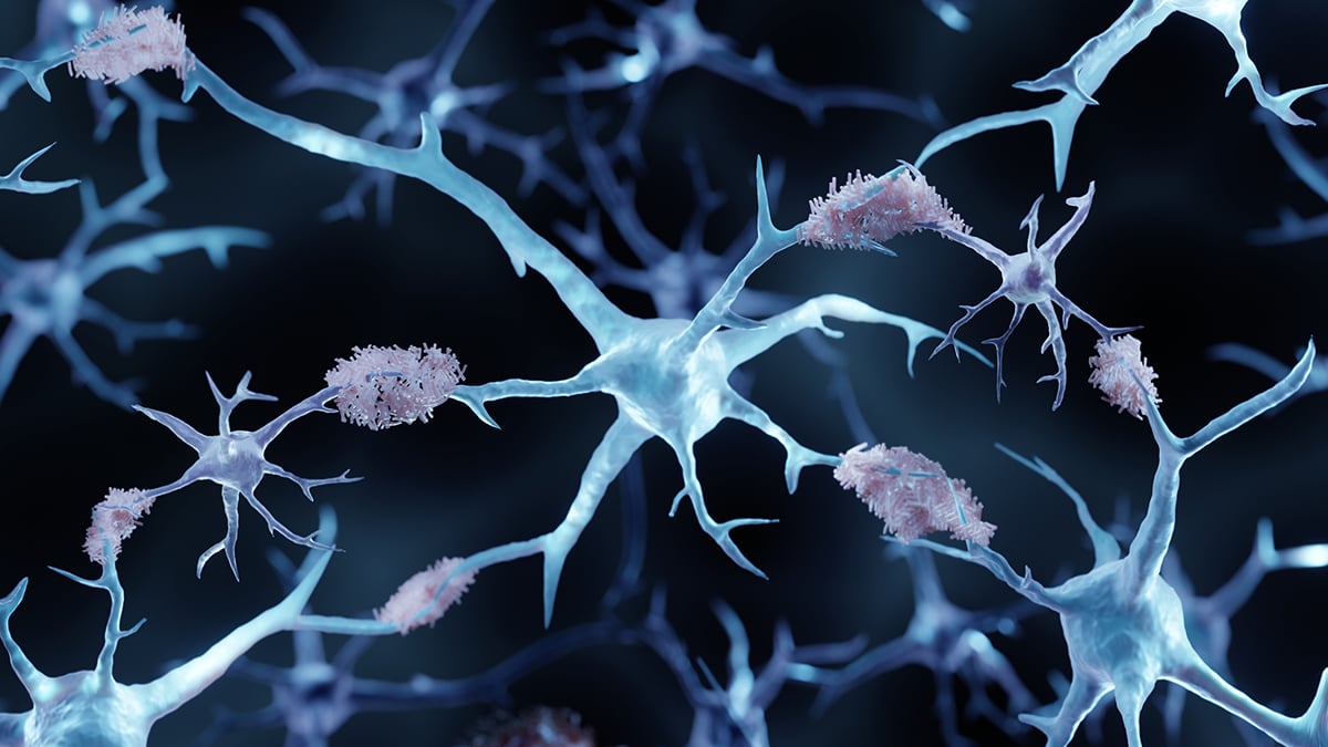 A Copper-Based Drug Clears Buildup of Alzheimer's Proteins in Mice : ScienceAlert